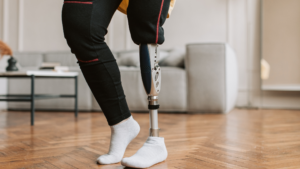 Person with Bionic leg
